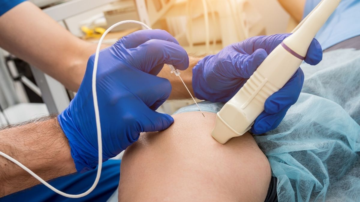 Doctor administers radiofrequency ablation treatment to Phoenix, AZ personal injury patient.