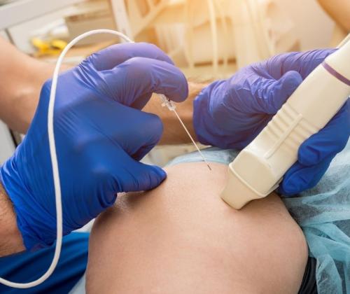 Doctor administers radiofrequency ablation treatment to Phoenix, AZ personal injury patient.